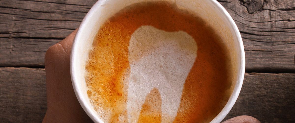 Fogfehérítés után kávé?